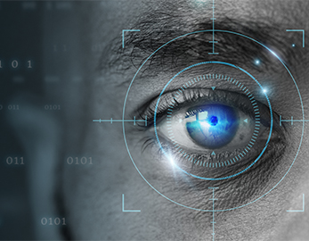 Vision Analysis